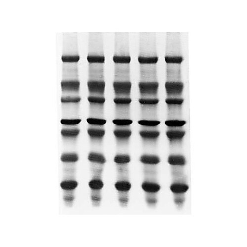 Immobilon−PSQ PVDF 0