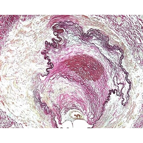 1.15974.0002 エラスチカ・ワ