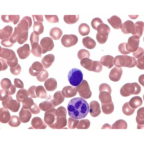 1.01350.0010 ライシュマンエ