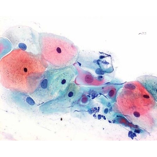 1.09272.2500 パパニコロウ染