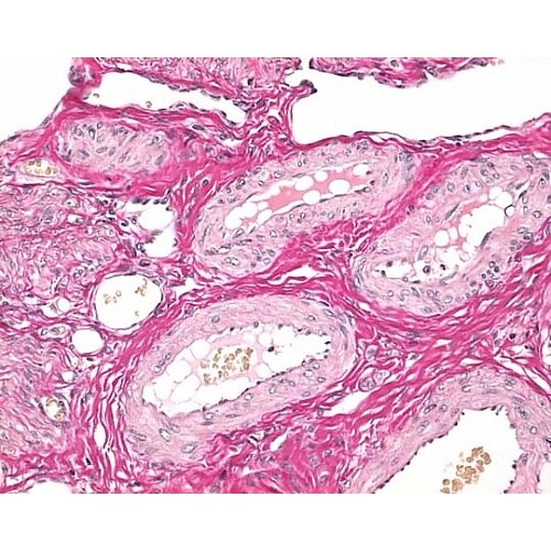 1.15973.0002 ワイゲルト鉄へ