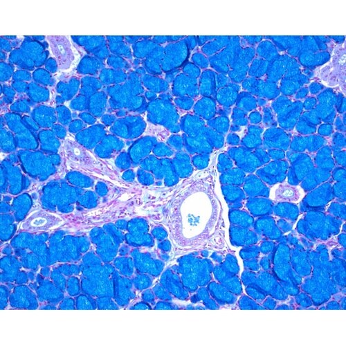 1.00425.0001 ISOSLID