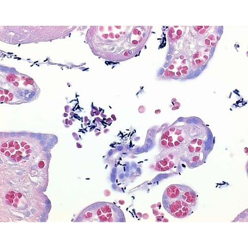 1.00567.1000 ルゴール溶液