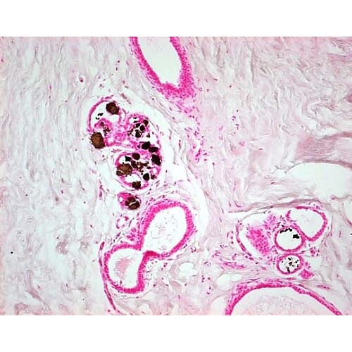 1.00362.0001 コッサ 鍍銀染
