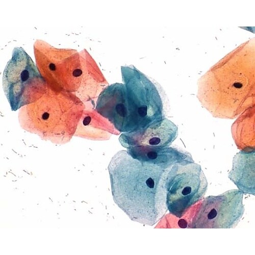 1.09269.0100 パパニコロウ染