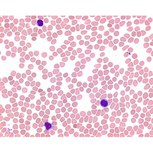 1.01424.0503 メイ−グリュン