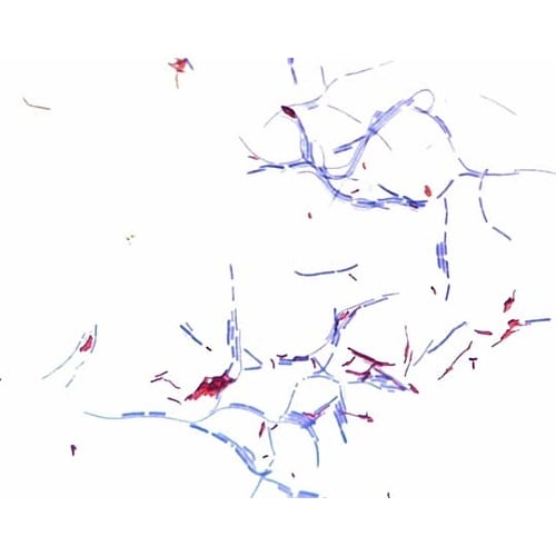 1.09215.0100 チール‐ネルセ