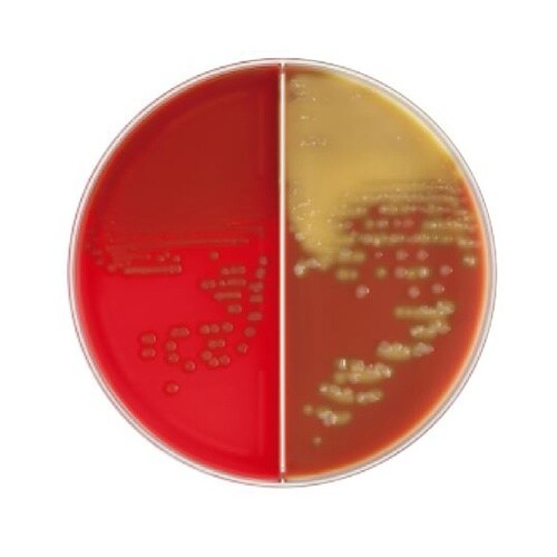 251302血液/チョコII寒天培地20枚