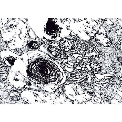 1.12179.0025 グルタルアルデ