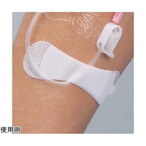 カテーテル固定用パッチ グリップロック