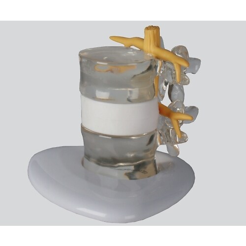 ヘルニアモデル 190×160×140