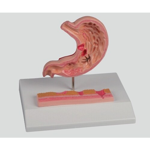 胃潰瘍モデル 120×90×20