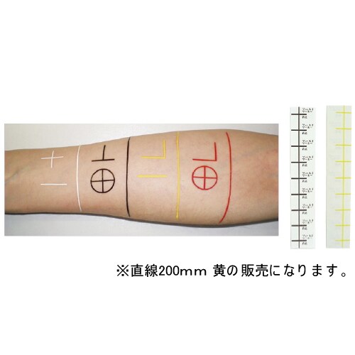 放射線治療用フィールドマーカー 直線200mm 黄
