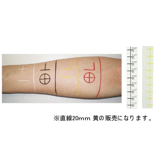 放射線治療用フィールドマーカー 直線20mm 黄