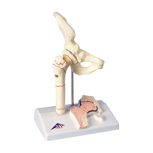 大腿骨骨折モデル A88