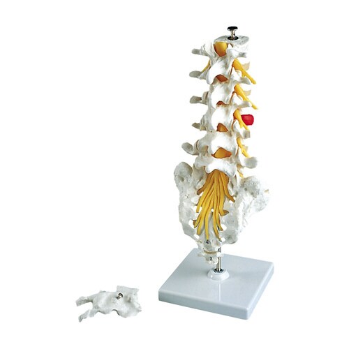 腰椎モデル(ヘルニア付) A76/5