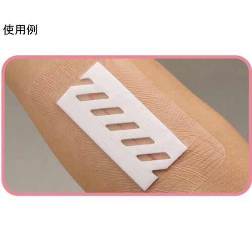 サージフィット(手術用被覆・保護材)