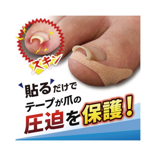 巻き爪テープ クイこまなーい