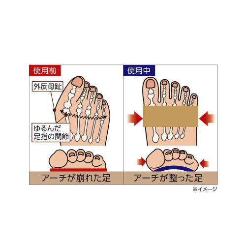 プラスウォーク 薄型外反母趾サポーター