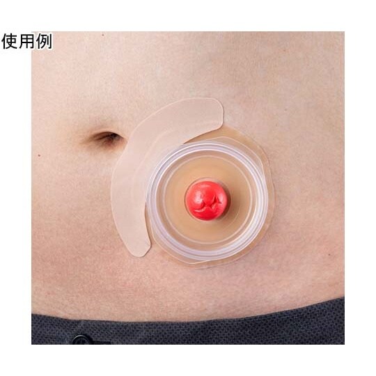 メクレガードテープ(ストーマ用装具固定テ