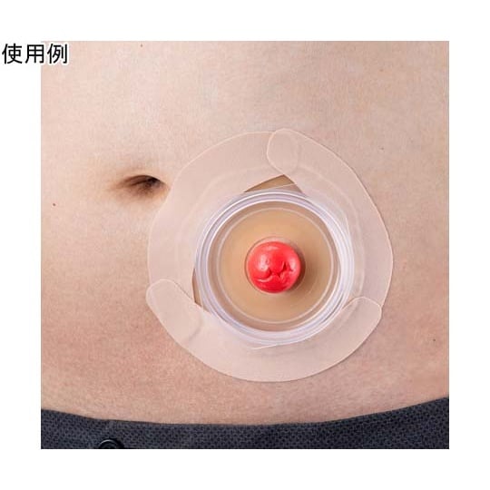メクレガードテープ(ストーマ用装具固定テ