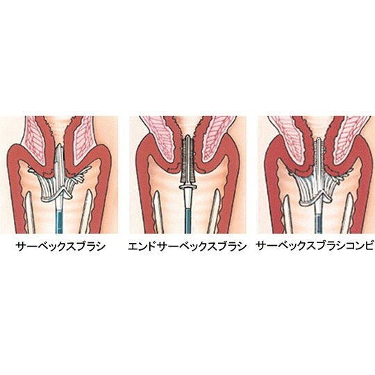 頸部頸管細胞採取ブラシ Cervex−B