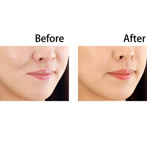 フェイストレッチ