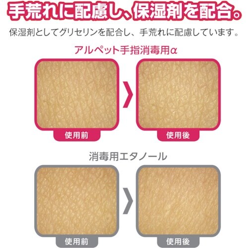 サラヤ アルペット手指消毒用アルファ 1L P付