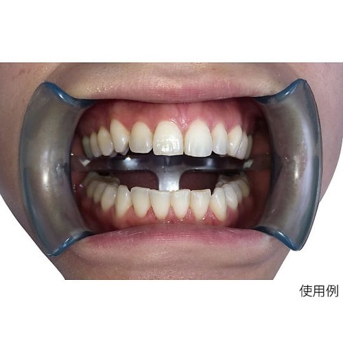 イントラオーラルチークリトラクター 大人