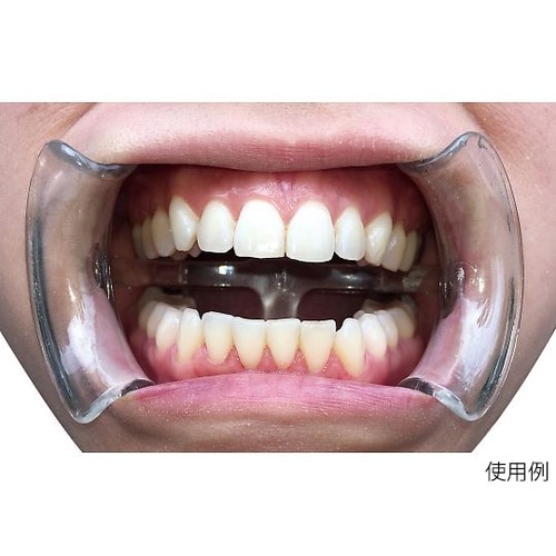 イントラオーラルチークリトラクター ディ