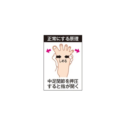 外反母趾サポータ スキニーフィット茶S右