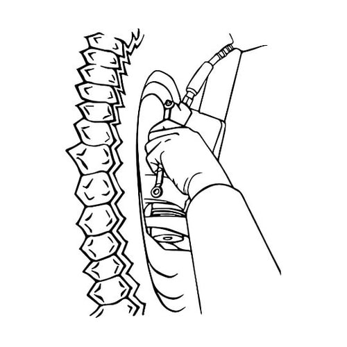 7x 9mm ブリーダープラグめがねレン