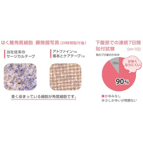 アトファイン傷あとケアテープ 50×16