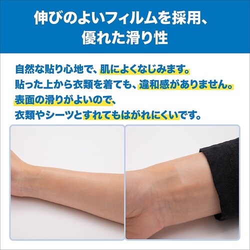 カテリープラスロール(ショートタイプ)1