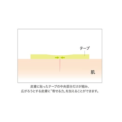 No.M30 アトレスケア50×50mm