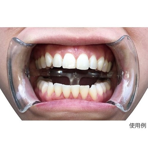 イントラオーラルチークリトラクター ディ