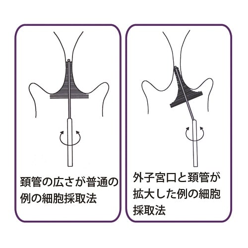 細胞採取器具KBS 90本