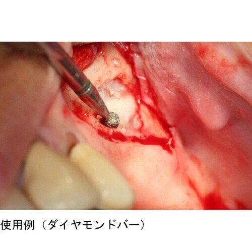 サージェリーダイヤモンドバー RA エク