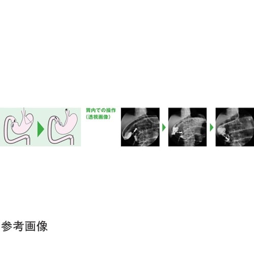 医≫イレウスチューブ(CP親水性G先導子Ba