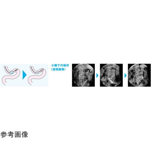 医≫親水性イレウスチューブ(CP−ES)16