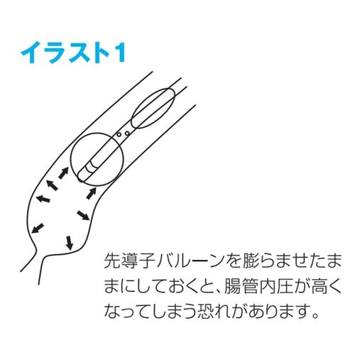 医≫親水性イレウスチューブ(CP−ES)16