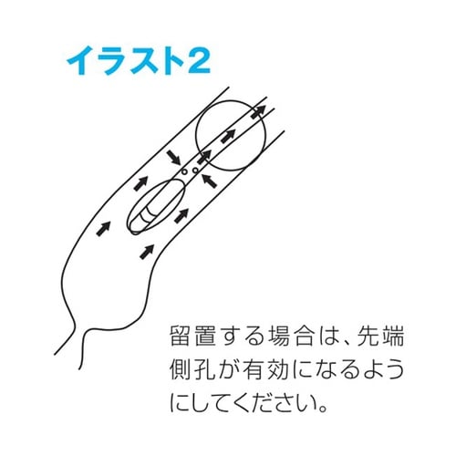 医≫親水性イレウスチューブ(CP−ES)18