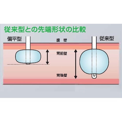 医≫胃瘻交換用カテーテル(クリニー 偏平バル