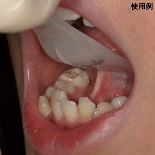 滅菌タングリフト TL−01