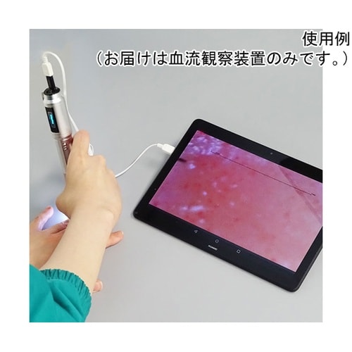 高速オートフォーカス血流スコープ 血流観