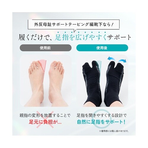 外反母趾サポートテーピング編靴下 ブラッ