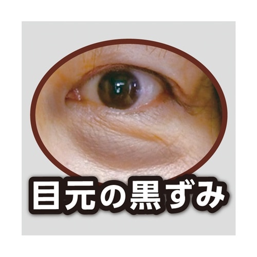アカラナインG