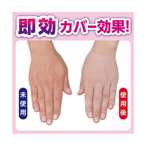 アカラナインG