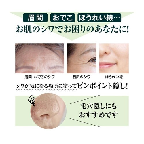 ミゾレッチ フラットカバー