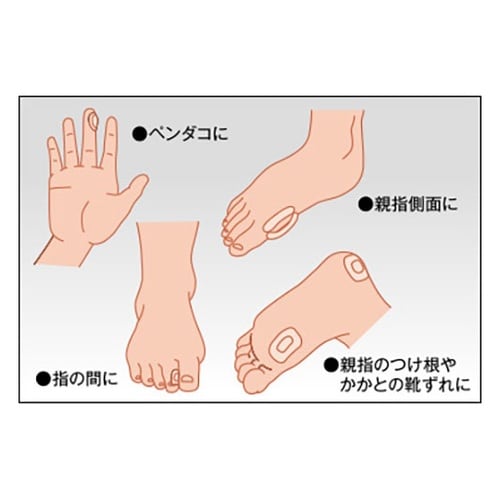 【5セット】 ソルボバン フリータイプ#